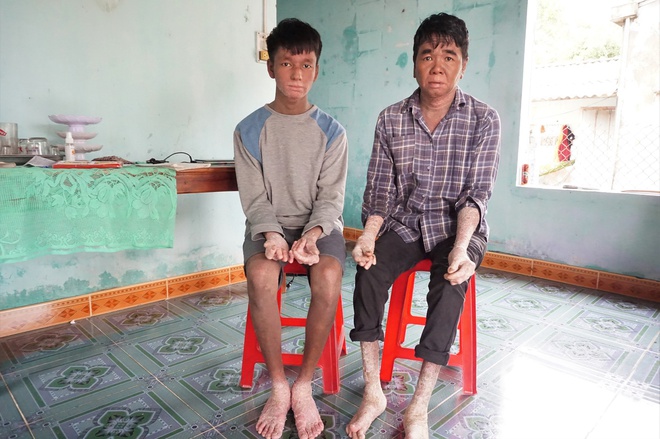 Cuộc sống của cha con người rắn ở Quảng Nam giờ ra sao? - Ảnh 1.