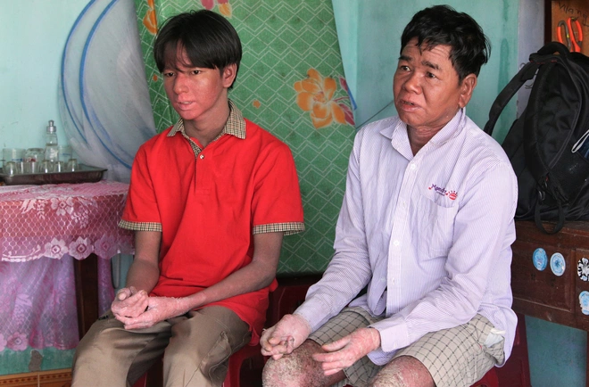 Cuộc sống của cha con người rắn ở Quảng Nam giờ ra sao? - Ảnh 5.