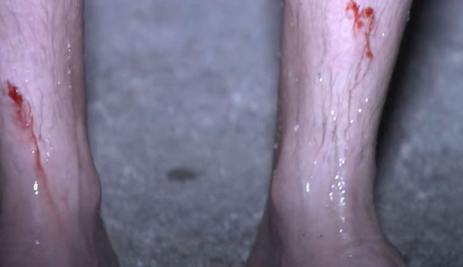 2 nghệ sĩ chấn thương ở Sao Nhập Ngũ: Người chân rướm máu, người phải chụp X-Quang ngay trong đêm - Ảnh 8.