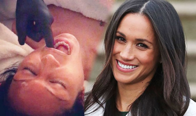 Để níu giữ tuổi xuân, Meghan Markle thực hiện liệu pháp khiến người ta mắt tròn mắt dẹt - Ảnh 7.